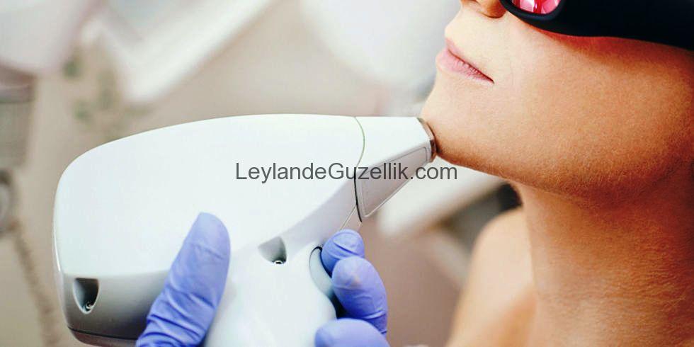 Özel Leylande Güzellik Salonu Maltepe Lazer Epilasyon Fiyatları
