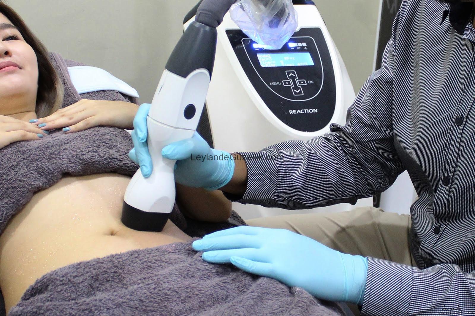Soğuk Lipoliz Kullananlar Kullanıcı Yorumları Lipoliz Fiyatları 2018 Soğuk Lipoliz Kullananlar Kullanıcı Yorumları Lipoliz Fiyatları 2018