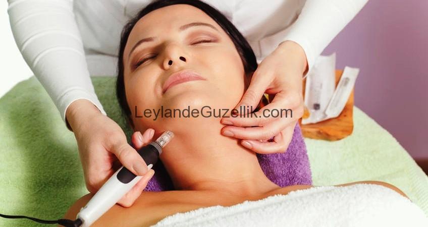 Dermapen Nedir Faydaları Sivilce Uygulamasi – Dermapen Cilt ve Saç Yenileme