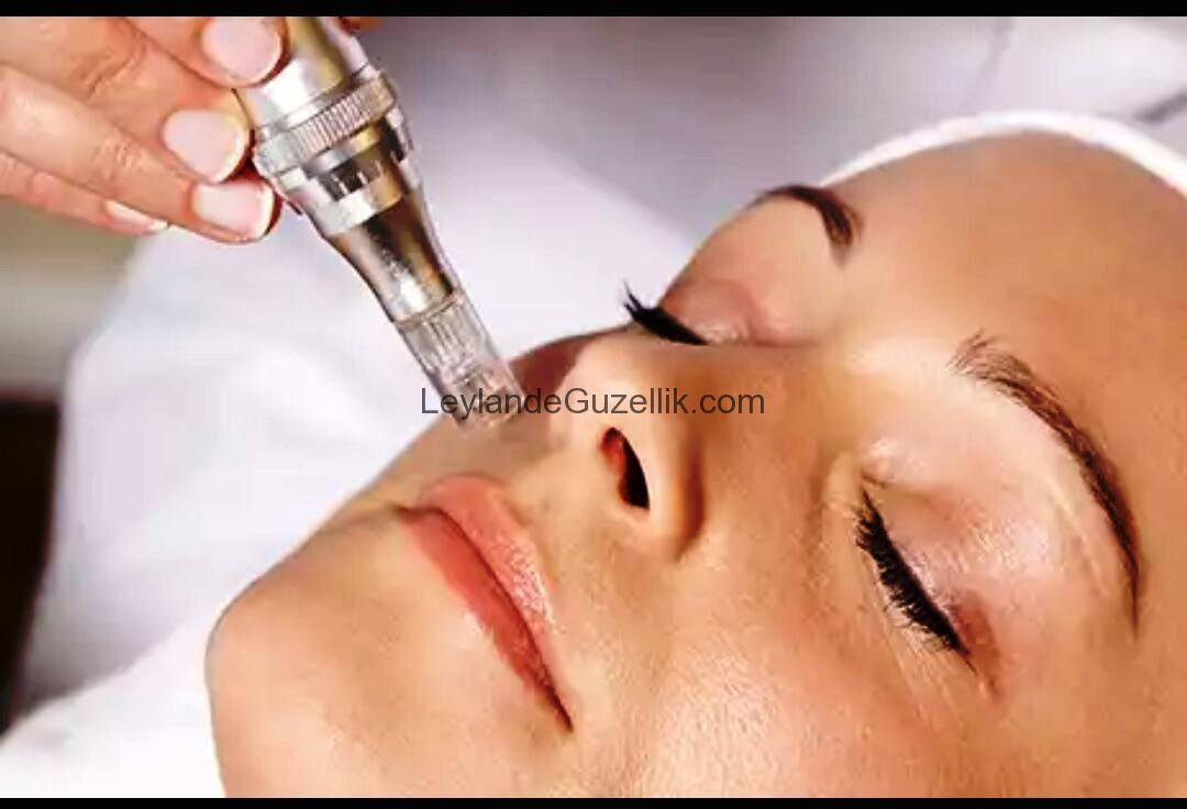 Dermapen Maltepe Dermapen Fiyat Cilt Gençleştirme Fiyatları İstanbul
