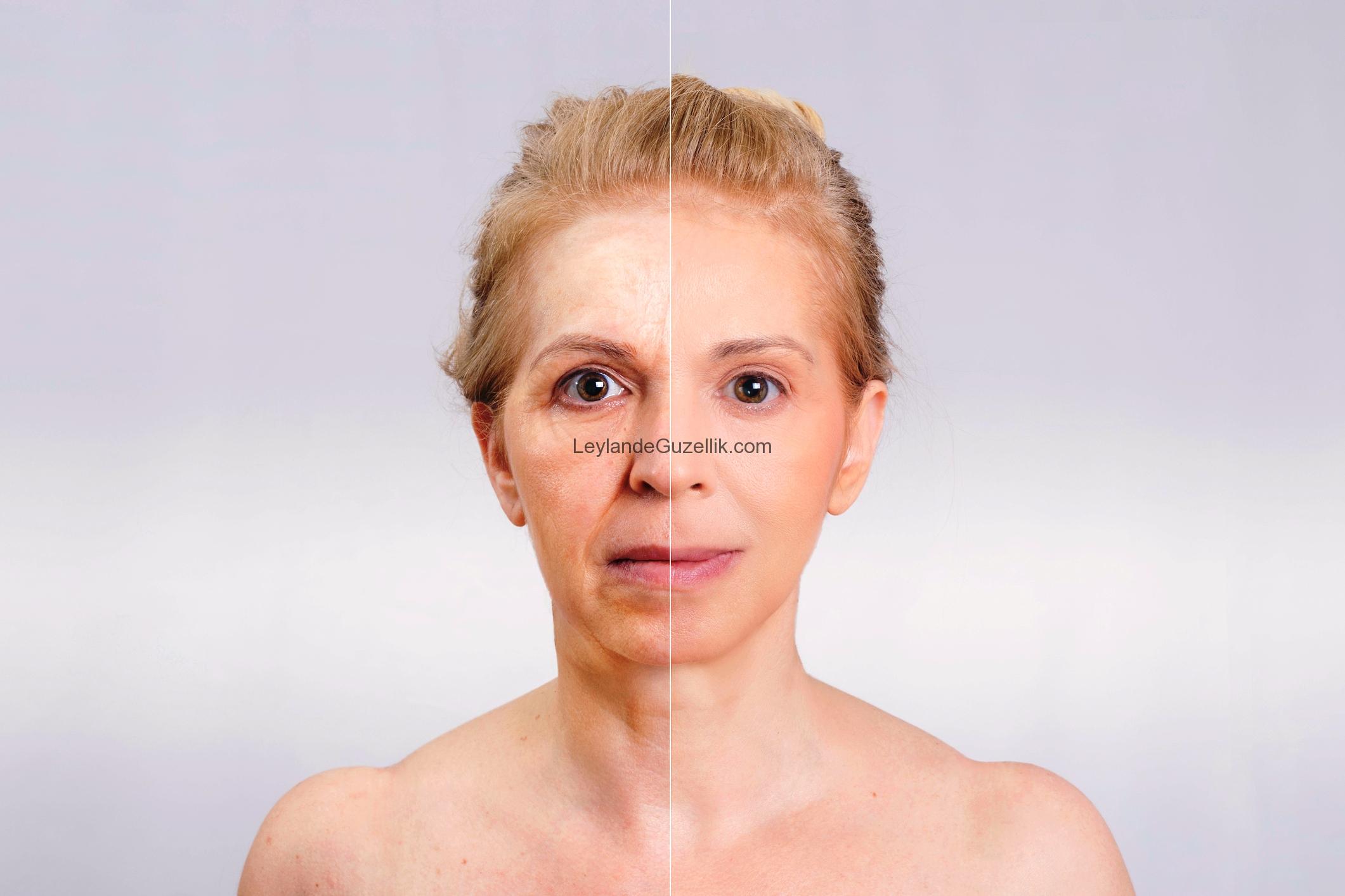 PRP Uygulamasi, Platelet Rich Plasma Uygulaması Cilt Bakımı Fiyatı prp tedavisi, prp tedavisi diz için, prp tedavisi saç, prp tedavisi yorumlar, prp tedavisi nedir nasıl yapılır, prp tedavisi fiyatları 2017, prp tedavisi yaptıranlar, prp tedavisi ekşi, prp tedavisi kadınlar kulübü, prp tedavisi ortopedi, prp tedavisi leylande güzellik salonu, prp tedavisi leylande güzellik salonu maltepe, prp tedavisi leylande güzellik maltepe, prp tedavisi maltepe, prp tedavisi fiyatları maltepe, prp tedavisi fiyatları maltepe leylande, prp tedavisi fiyatları maltepe leyla demirci,